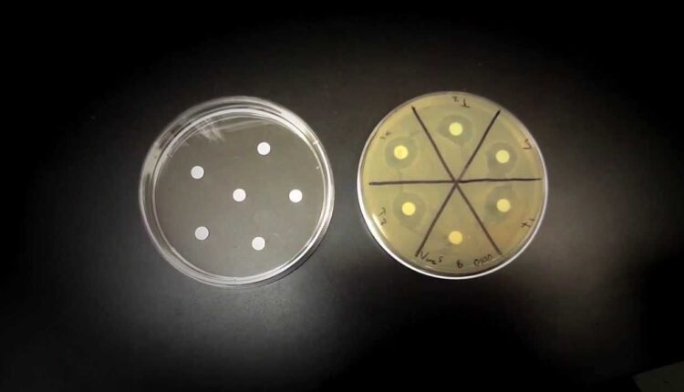 مروری بر آزمون‌های تعیین حساسیت ضد میکروبی و روش‌های نویدبخش در آینده