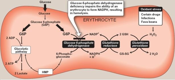 گلوکز-6- فسفات دهیدروژناز