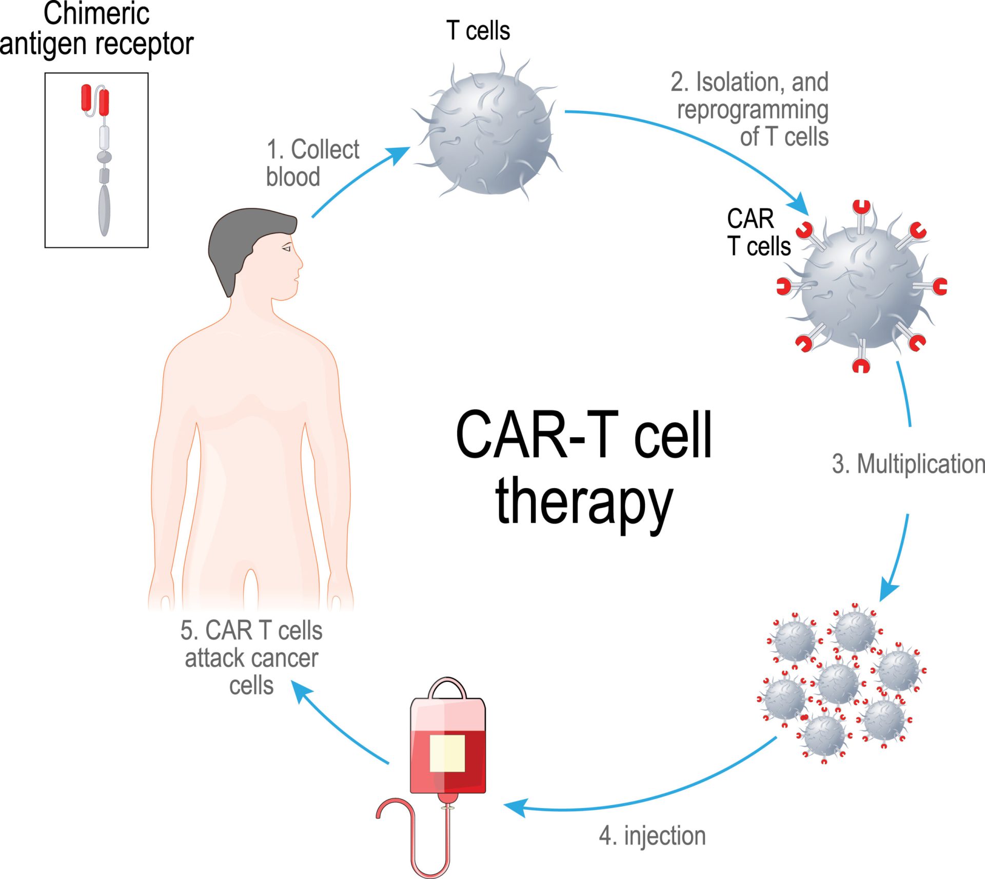 CAR T cell therapy