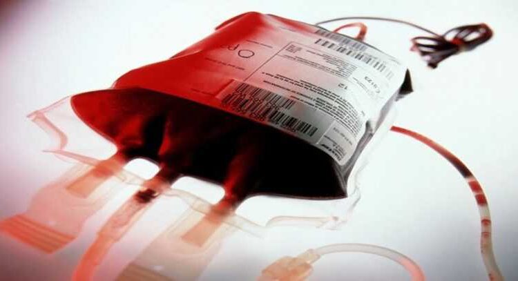پرسش و پاسخ‌های آزمایشگاهی و کاربردی در طب انتقال خون