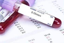 گزارش آزمایشگاهی D-dimer