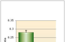  Evaluation of Urinary Calcium Creatinine Ratio in