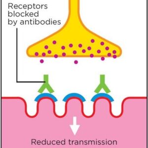 میاستنی گراویس پاسخ ایمونولوژیک علیه یک یا چند پروتئین از منطقه واسطه‌ای عصبی- عضلانی