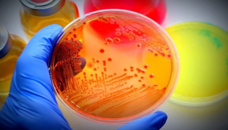 مروری مختصر بر محیط‌های کشت مورد مصرف در آزمایشگاه میکروب‌شناسی